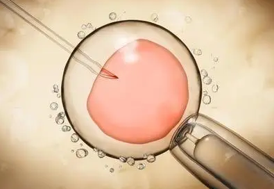 精液分析